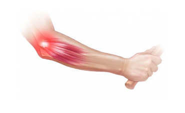 IN-FORMA: Epicondilite